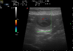 Wurf erwartet Januar 26 -FCI-Labradorzucht aus den Kristallh�hlen